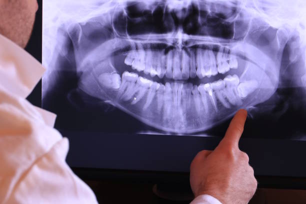 Best Emergency Treatment for Toothache in Phelan, CA