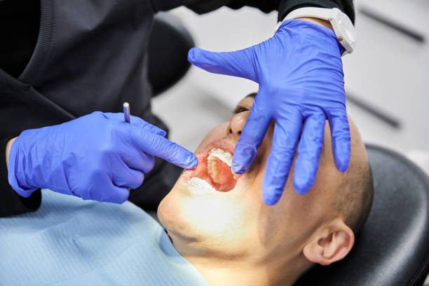 Best Emergency Tooth Extraction in Phelan, CA