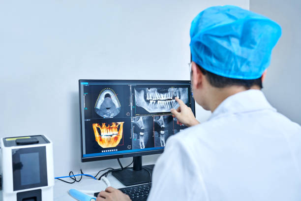 Best Emergency Wisdom Teeth Removal in Phelan, CA